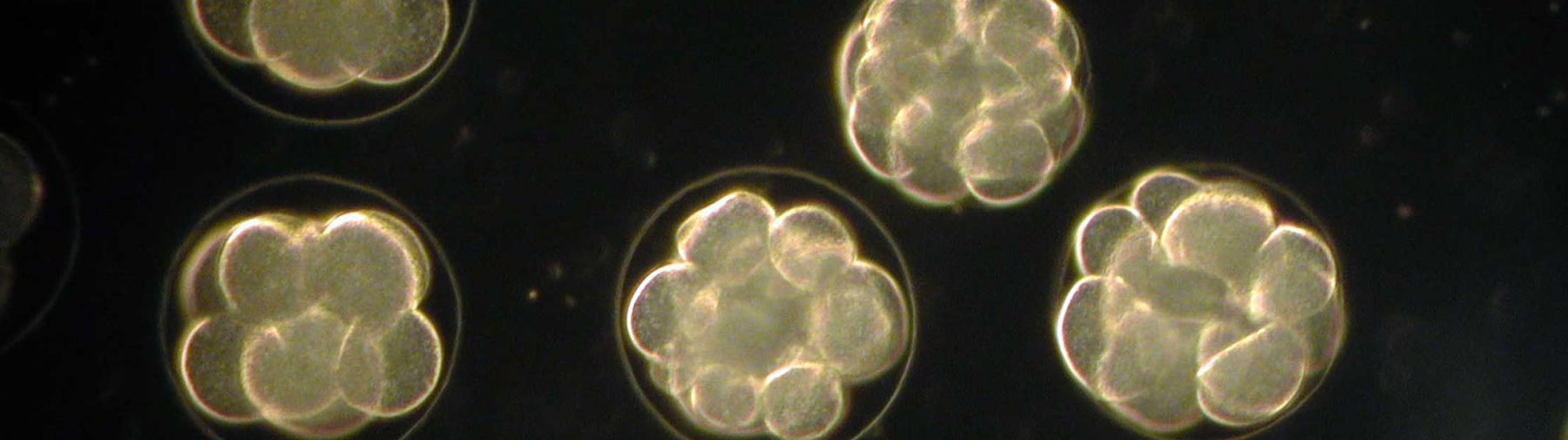 Sea Urchin Embryos